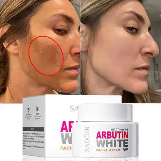 Sadoer Nicotinamide Arbutin White Facial Cream 50g - Buy Online in Bangladesh | ePharma