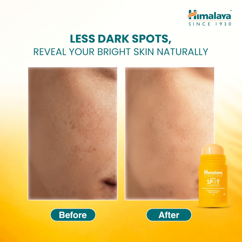 Himalaya Dark Spot Clearing Turmeric Clay Stick Mask 30g - Buy Online in Bangladesh | ePharma
