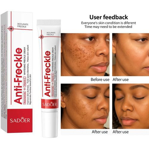 Sadoer Anti Freckle Cream 20g - Buy Online in Bangladesh | ePharma