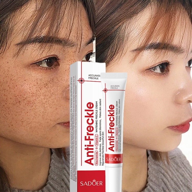 Sadoer Anti Freckle Cream 20g - Buy Online in Bangladesh | ePharma
